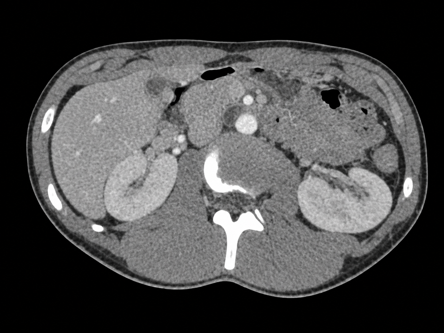 CT at Merivale Medical Imaging