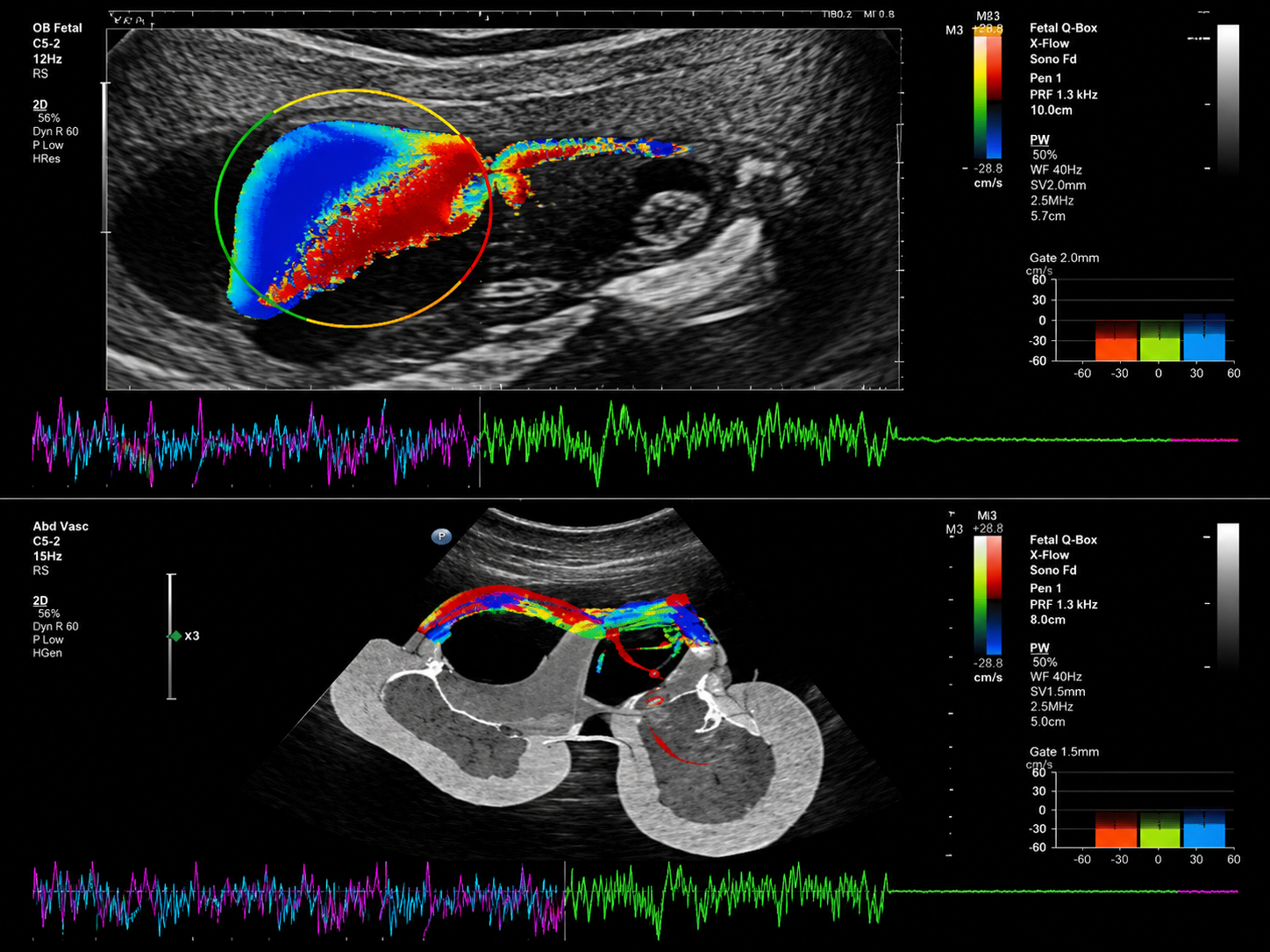 Echocardiogram at Merivale Medical Imaging
