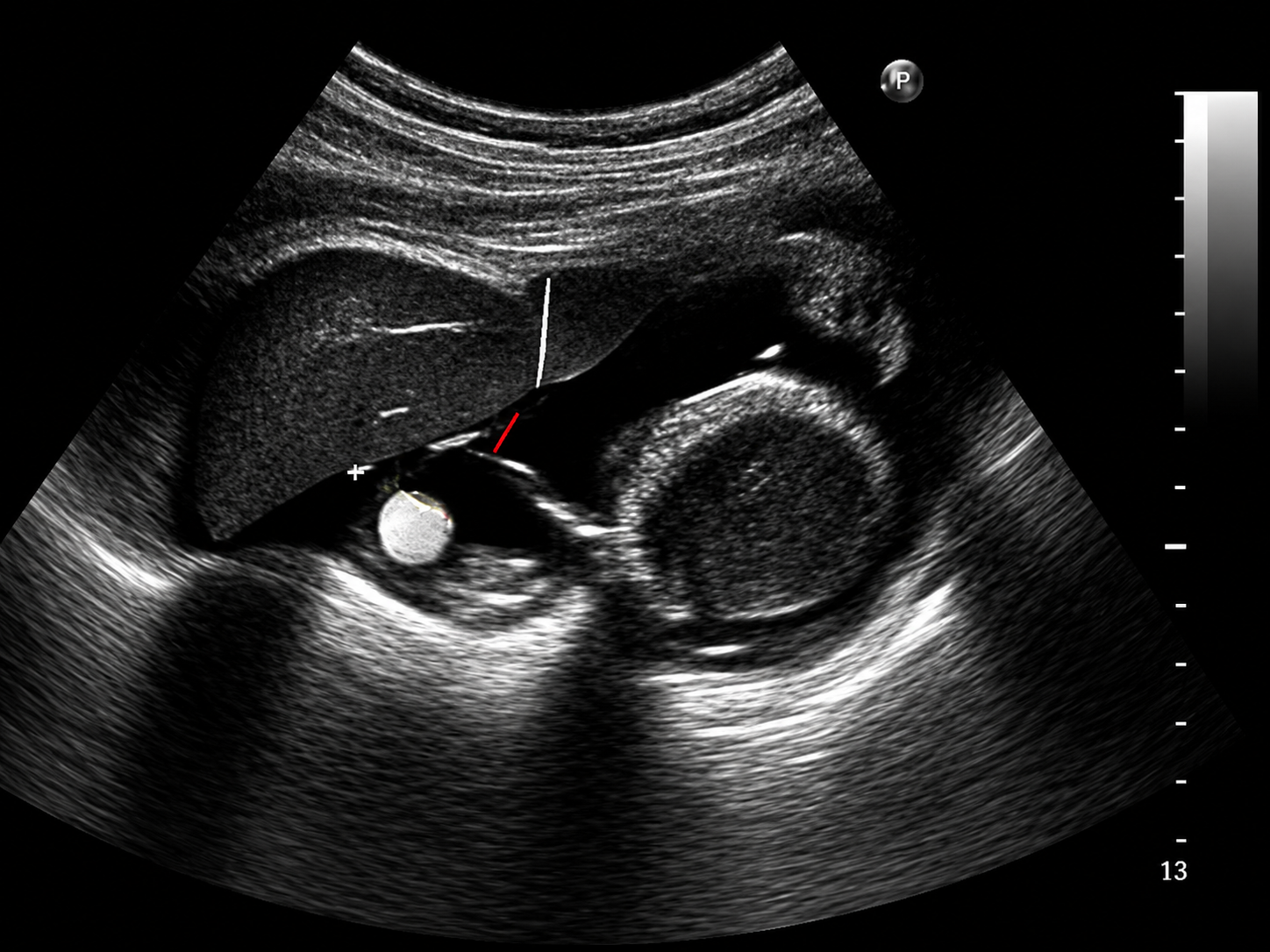 General Ultrasound at Merivale Medical Imaging