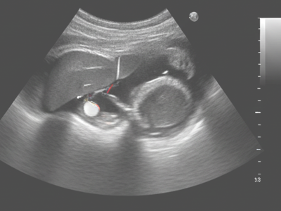 General Ultrasound at Merivale Medical Imaging