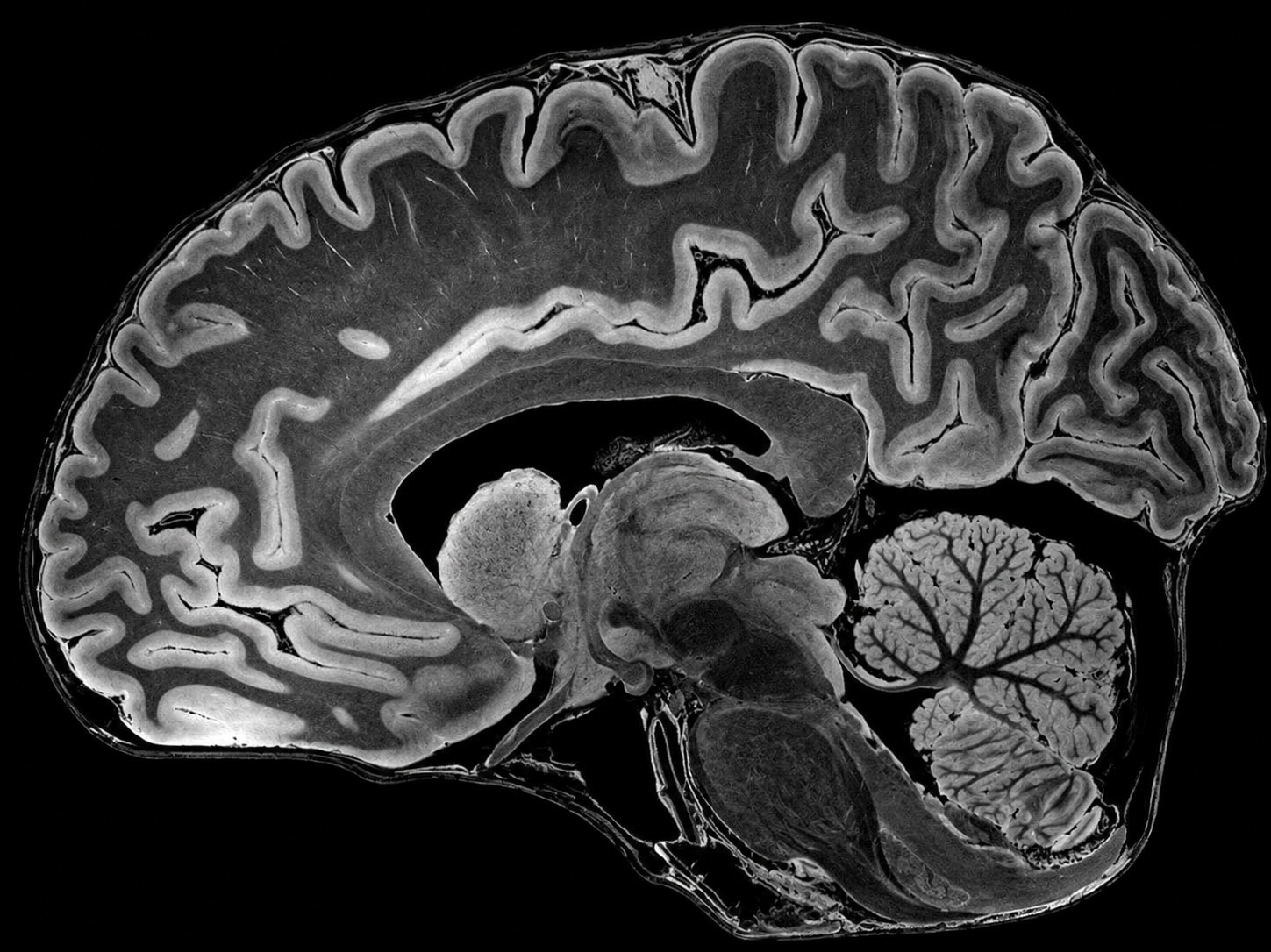 MRI at Merivale Medical Imaging