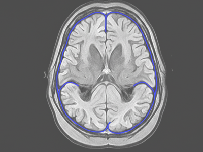 MRI at Merivale Medical Imaging
