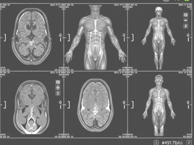 Preventative Health MRI at Merivale Medical Imaging