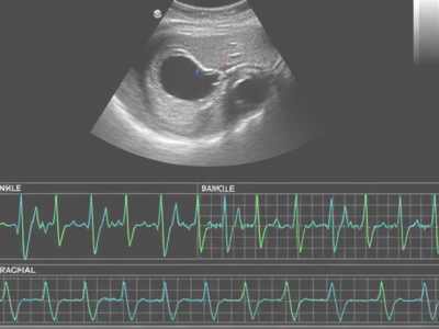 Vascular Ultrasound / ABI at Merivale Medical Imaging