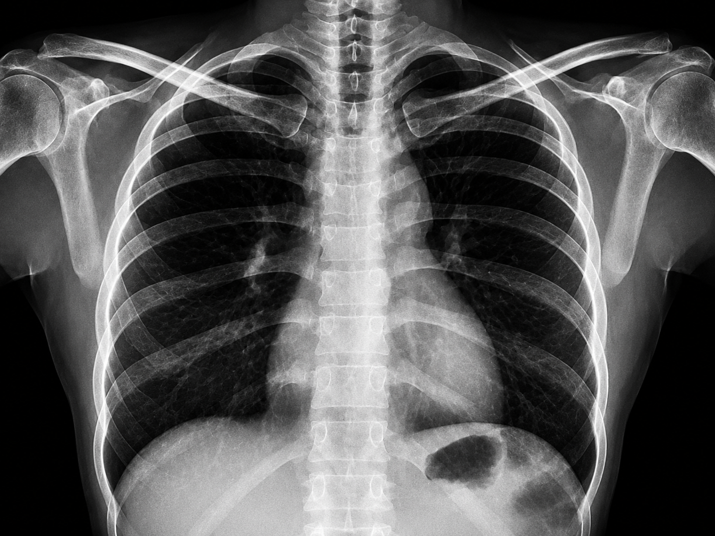 X-Ray at Merivale Medical Imaging