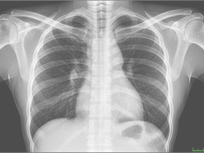 X-Ray at Merivale Medical Imaging